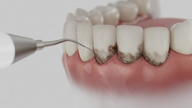 Trusted Wisdom Tooth Removal service in Bastrop, TX - Dentist Open Now